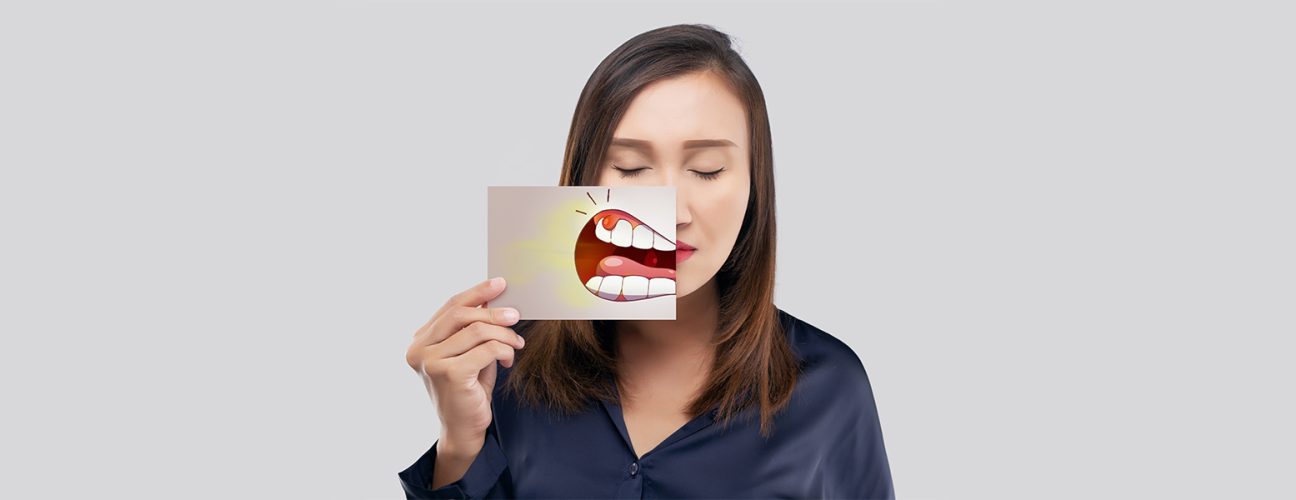 Dark Red Gums Below Teeth: When to See a Dentist