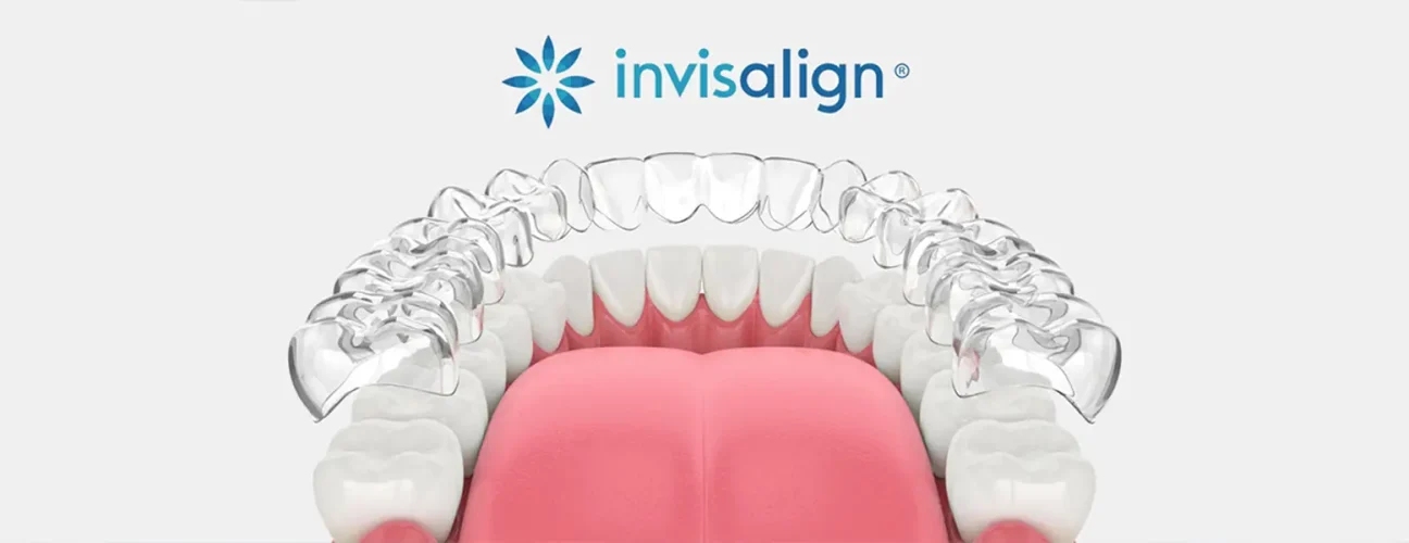 Am I Too Old for Invisalign? Adult Orthodontics Myths Debunked